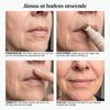 MJORA™  Line Smoother Perfekt Hud på 3 Minuter
